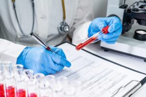 List of common blood tests
