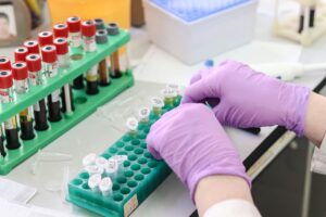 ESR test म्हणजे काय ESR test information