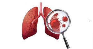 Bronchitis meaning in Marathi।