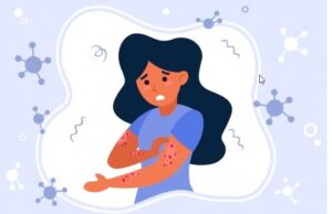 लेपरोसी म्हणजे काय? लक्षणे, उपचार- Leprosy meaning in Marathi